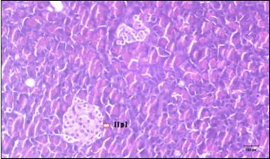 Photomicrogragh of pancreas section of treated rat with Fenugreek showing less improved islets of Langerhans with more cells (star). (H&E) (40X).