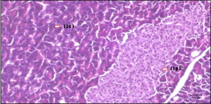 Photomicrogragh of pancreas section of treated rat with both Fenugreek and Glimepiride showing nearly normal islets of Langerhans with spindle (arrow) & polygonal cells (dashed- arrow). (H&E) (40x).