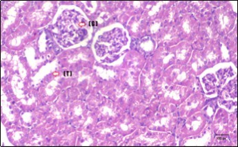 photomicrogragh of kidney section of control rat showing normal rounded Bowman,s capsules with normal glomeruli  (arrow) ,round proximal tubules (dash-arrow) and elongated  distal tubules with high cuboidal cells (star) . (H&E) (40X)