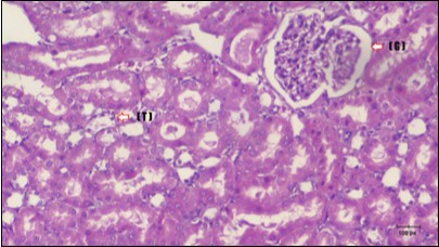 Photomicrogragh of kidney section of treated rat with Fenugreek showing improvement of Bowman,s capsules with normal glomerular (arrow) and nearly return of distal tubules (dashed –arrow) and proximal tubules (star) (H&E) (40xX).