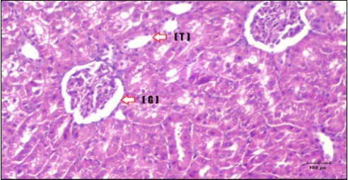 Photomicrogragh of kidney section of treated rat with Glimepiride showing improvement of Bowman,s capsules and partial improvement of glomerulir (arrow) and completely return of distal tubules and proximal tubules to the normal shape  with wide urinary space. (H&E) (40X).