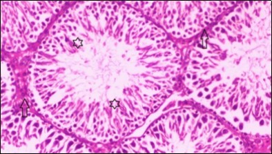 Photomicrogragh of testis section of treated rat showing increased number of  spermatogenic cells from spermatogonia till spermatozoa (star). Few liquid infiltration in wide interstitial tissue (H&E) (40X).