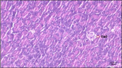 Photomicrogragh of pancreas section of diabetic rat showing the                  markedly atrophic islets of Langerhans. (arrow) (H&E) (40X).