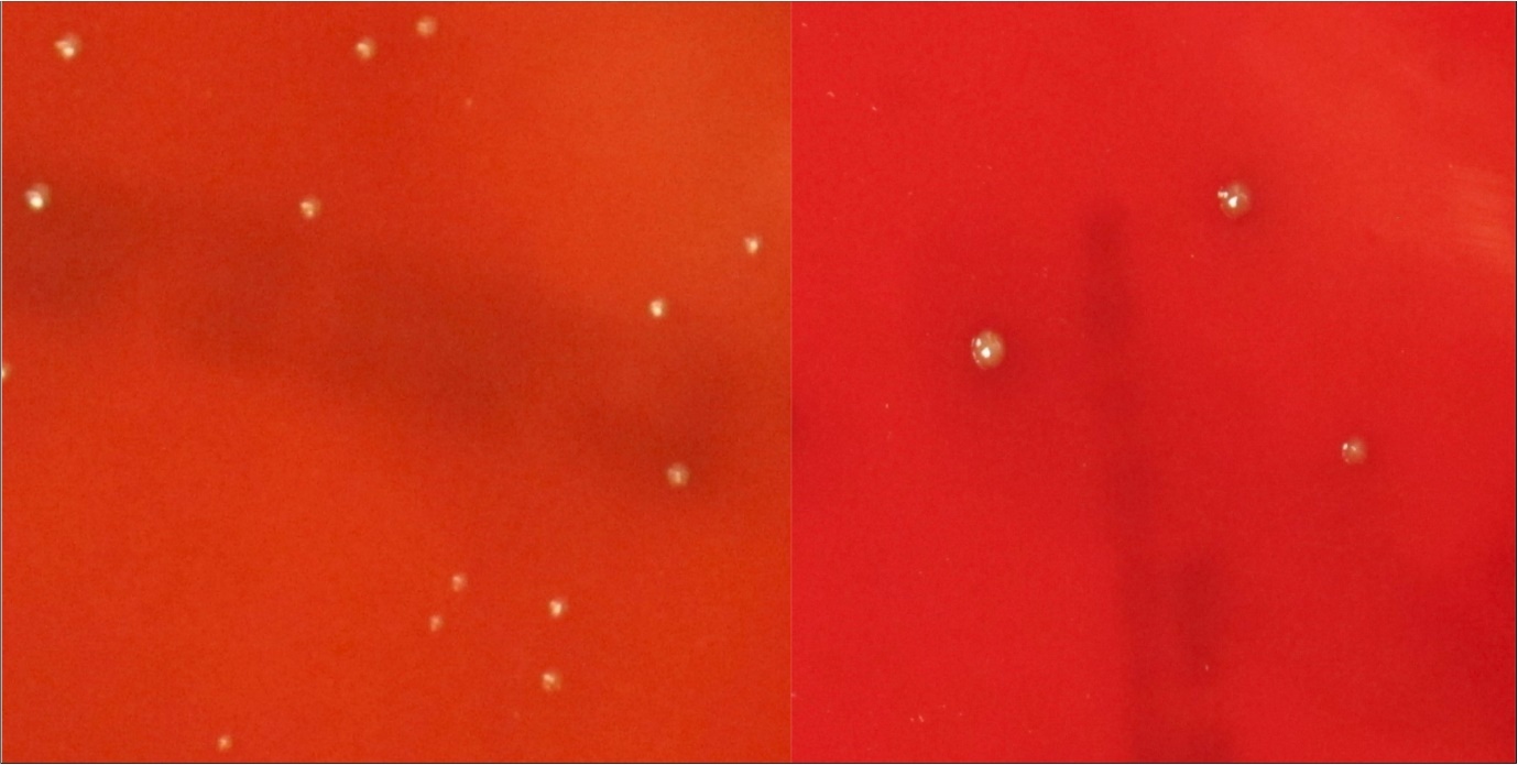 Porphyromonas Gingivalis; Culture plates (a) Control, (b) 120 seconds