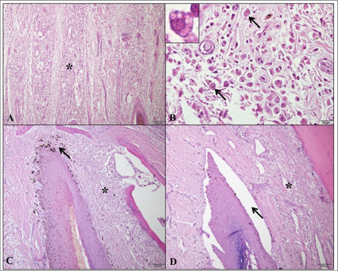 Photomicrographs of histopathological alterations in the different digit areas of dogs with visceral                leishmaniasis. (A) Inflammatory infiltrate (*) diffusely dispersed in dorsal epidermis/dermis (bar=100µm). (B) In the same area, inflammatory infiltrate containing macrophages with Leishmania spp amastigotes (arrows and     detail, bar=20µm). (C) Inflammatory infiltrate (*) and pigmentary incontinence (arrow) in the dorsal matrix/dermis (bar=100µm). (D) Inflammatory infiltrate (*) and marked dermoepidermal clefting (arrow) in the ventral matrix/dermis (bar=100µm). Hematoxylin and Eosin.