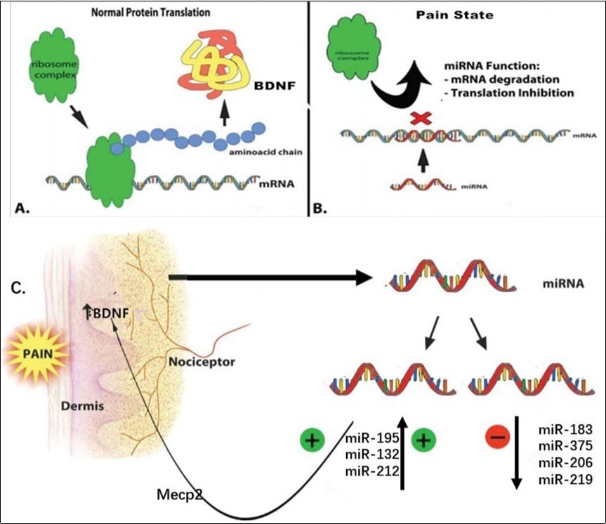 Epigenetic control of miRNA in pain state. A) Normal BDNF protein translaton. B) Functonof miRNA: mRNA degradaton and inhibiton of protein translaton. C) Changes in miRNA expression during pain: some increase, such as miR-195, and some decrease, such as                    miR-183, these changes cause pain by regulating the expression of BDNF