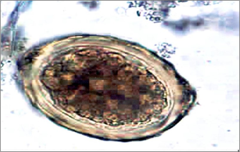 Ascaris egg