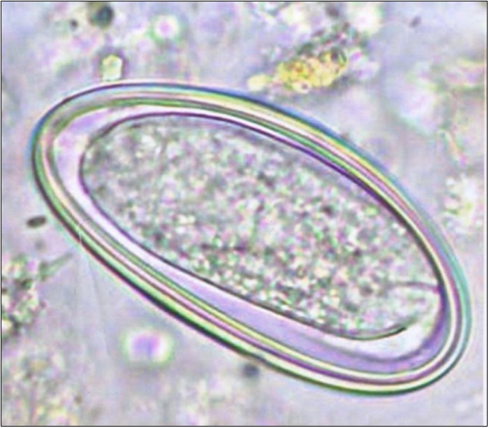 Enterobius vermicularis egg