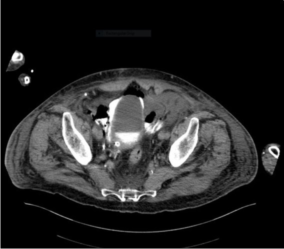 horizontal plane CT image 2
