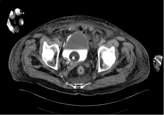 horizontal plane CT image