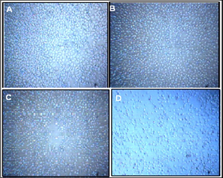 HTB-132 breast cancer cells viability before and after 24 hrs                  alendronate treatment. A: Control; B, C & D: 5µM, 10 µMand 20 µM ALN                         respectively.