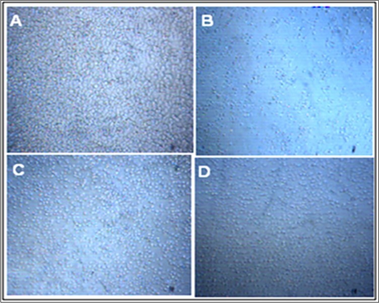 HTB-132 breast cancer cells viability before and after 48 hrs               alendronate treatment. A: Control; B, C & D: 5µM, 10 µMand 20 µM ALN                   respectively.