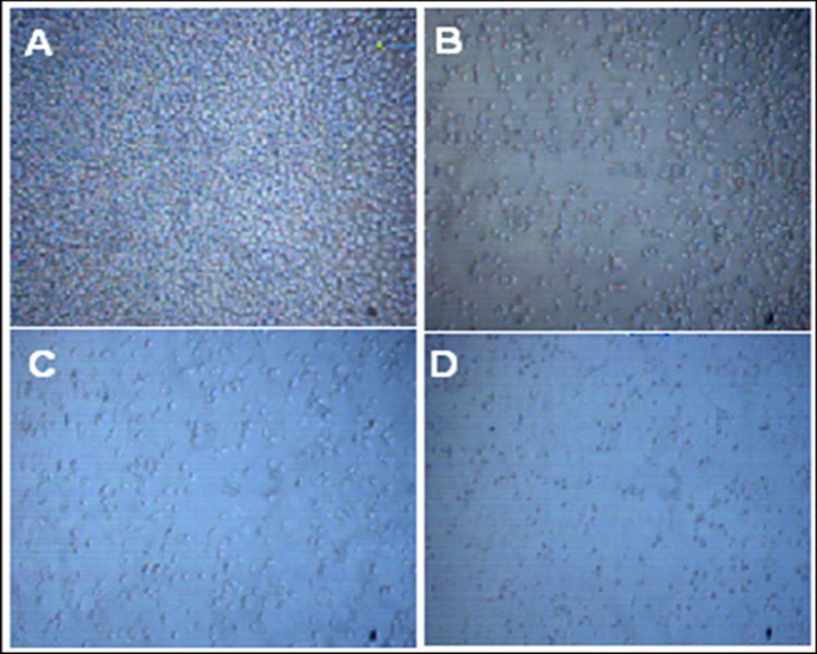 HTB-132 breast cancer cells cytotoxicity before and after 72 hrs          alendronate treatment. A: Control; B, C & D: 5µM, 10 µMand 20 µM ALN                 respectively.