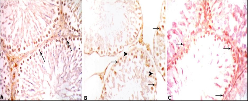 Photomicrographs of testis sections of different groups: A) Control group showing strong positive immunostaining in spermatogonia (arrows). B) PTU-treated group showing weak positive immunostaining with PCNA detected in some spermatogonia (arrows) and negative immunostaining in other spermatogonia (head arrows). C) PTU and LC-treated group showing positive                          immunostaining with PCNA- stronger than the PTU treated group but still weaker than the control group detected in spermatogonia (arrows). PCNA x 400