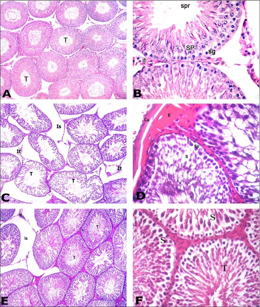 Photomicrographs of testis sections of the different groups: A) Control group showing round seminiferous tubules (T) with regular contour. Tubules appear packed together with narrow interstitial space. B) Higher                magnification of the previous section showing the different spermatogenic cells of the germinal epithelium including: spermatogonia (sg), primary spermatocytes (SP) and sperms (spr). Cluster of interstitial cells of Leydig (It) present in the narrow interstitial space. C) PTU-treated group showing loss of normal round seminiferous tubules (T) that appear with irregular contour. Widening of the interstitial space (Is) through which remnants of interstitial cells of Leydig (It) can be recognized.  D) Section in the PTU treated group showing thick capsule (Ca) with subcapsular acidophilic hyaline material deposition (E). Germinal epithelium showed gap spaces (s) present among cells. Primary spermatocyte (Sp). E) PTU and LC treated group showing restoration of many seminiferous tubules (T) to their    normal shape with regular contour. Most tubules restored its tight junction however there is still widening in the interstitial space (Is), remnants of Leydig cells (It) and gap spaces (s) between spermatogenic cells of some tubules. F) Section in the PTU and LC treated group showing that germinal epithelium begins to restore its normal cellular composition. Seminiferous tubules (T) contained whorls of sperms. However, gap spaces (S) between epithelial cells are still present. A C & E: H&E X 100; B D &F: H&E X400