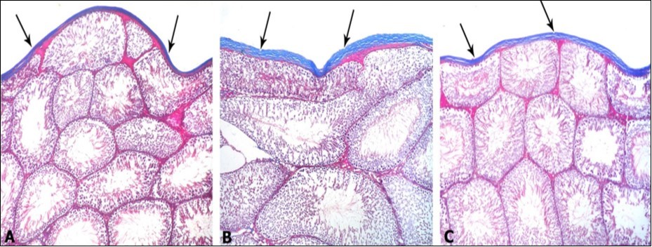 Photomicrographs of testis sections of different groups: A) Control group showing the normal distribution of the collagen fibers located in the capsule (arrows). B) PTU-treated group showing marked increase in collagen fibers distribution in the capsule (arrows). C) PTU and LC group showing decrease in collagen fibers distribution (arrows) in the testicular capsule in comparison to the PTU treated group. Mallory’s trichrome x 100