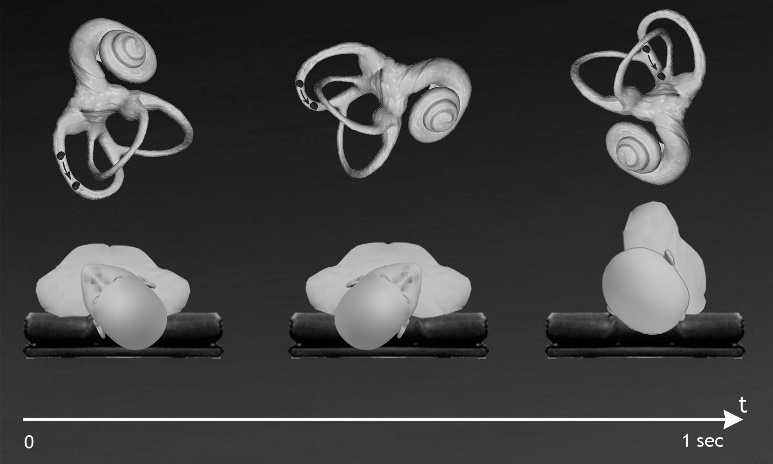 The “Quick Liberatory Rotation” maneuver for left posterior canal BPPV
