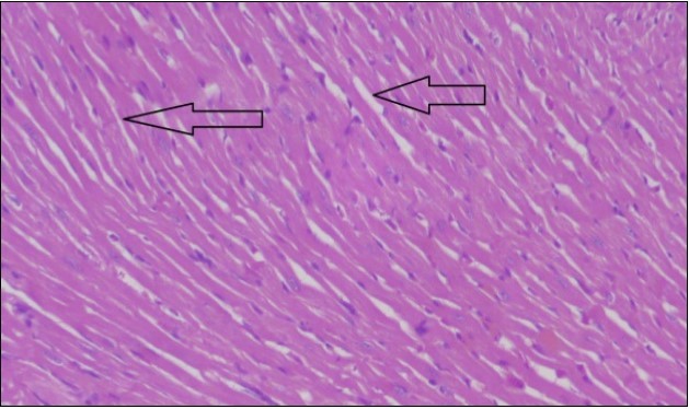 Photomicrograph of heart section of control rat showing normal cardiac tissue with elongated, un branched multinucleated muscle fibers (arrow), (H&E) (400X).