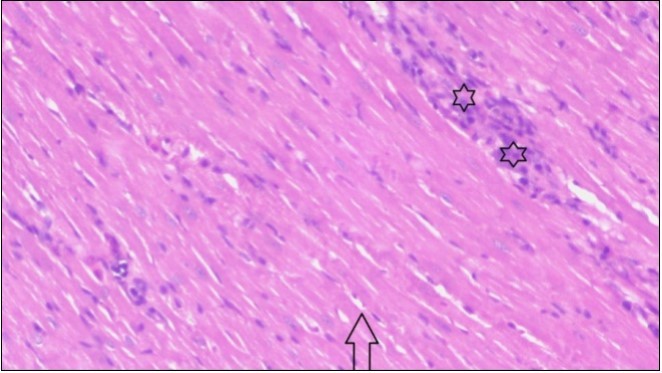 Photomicrograph of heart section of treated rat with fennel  herb showing improved cardiac tissue with less infiltration (star) and well organized elongated muscle fibers with peripheral nuclei (arrow), (H&E) (400X).
