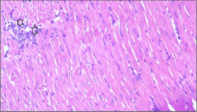 Photomicrograph of heart section of treated rat with Ator drug showing less improved cardiac tissue with few                       inflammatory cells between disorganized muscle fiber (star), (H&E) (400X).