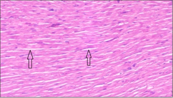 Photomicrogragh of heart section of treated rat with both fennel herb and Ator drug showing nearly normal cardiac tissue with well-organized  muscles fibers (arrow), (H&E) (400X).
