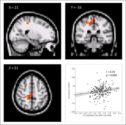 Correlation between seed-based functional connectivity (FC) and emotional conflict.  The FC between the AMY and the right supplementary motor area (SMA) was positively correlated with emotional conflict.  Scatter plot between the AMY-SMA FC and emotional conflict is shown for illustration purposes.