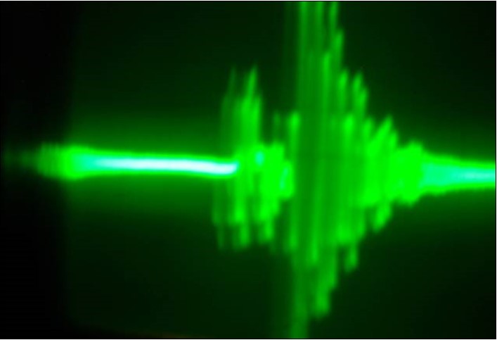 Oscillograph of the collector voltage in the physical model of the system (7) with two identical coils in two shoulders of the multivibrator – one on the                   ferrite core, the other – in the air.(Fig.13). Corresponds to the solution of (7) in Fig.15.Vert axis μsec/cm , Horiz axis-2volts per cm.