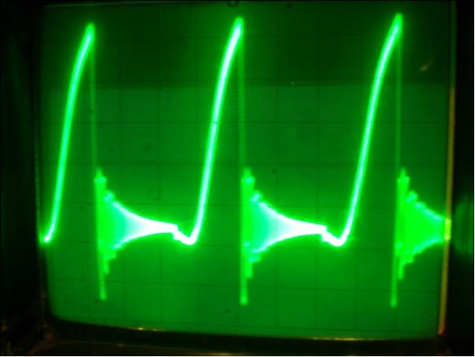 Oscillograph of the voltage on both          transistors collectors in the physical model of the               system (7) corresponding to the interaction process between two FPU recurrences corresponding to the interaction dynamics of the electron current Ielectron. and that of the phonon current Iphonon . The phonon current energy prevails. Vert axis milli sec/cm, Horiz axis-3volts per cm.