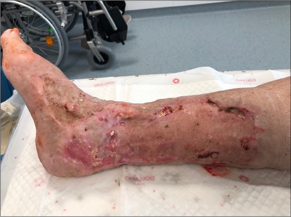 Gradual healing of small defects over the months may - august