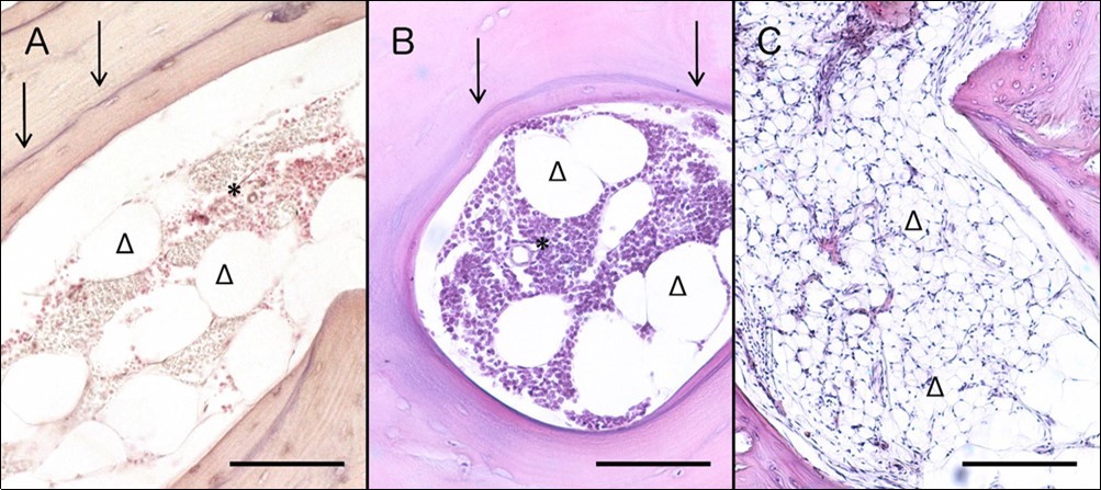 Histological evaluation of non-WM implants 3 (A), 4 (B) and 8 (C) months after implantation. Three months post implantation specimens (A) present restored cellularity and large adipocytes, while the sharp cement lines clearly separate old and new bone; H&E; Scale bar: 0.1mm. Four-month specimens (B) present a highly similar histological profile with 3 months, in terms of restored cellularity, large adipocytes and clear cement lines; H&E; Scale bar: 0.1mm. Eight months after surgery (C), bone marrow of                  xenografts present also restored cellularity and small adipocytes; H&E; Scale bar: 0.2mm. Cellularity is         labelled with asterisks, adipocytes with triangles, and cement line with arrows.