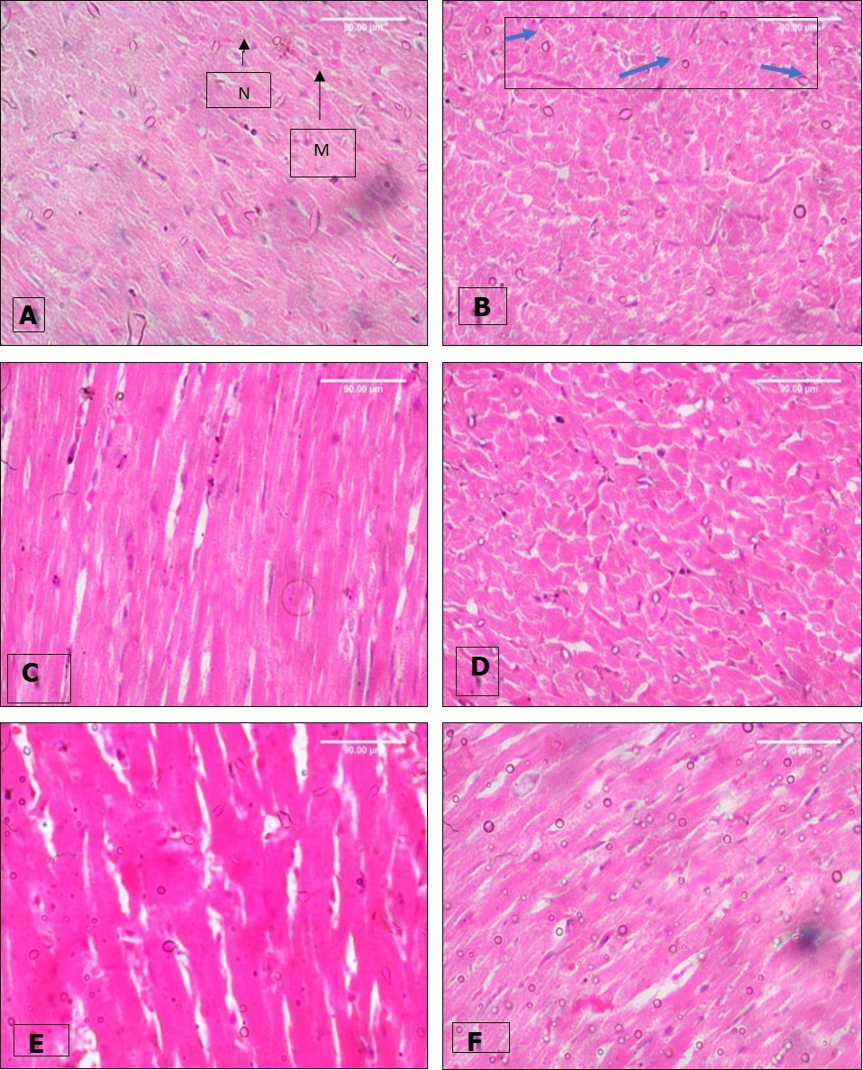 Effect of paraquat exposure on the histo-architecture of the rat heart (A) Control, (B)                   Paraquat only, (C) MEAS 100mgkg-1, (D) MEAS 200mgkg-1, (E) Vitamin E 100mgkg-1, (F) Paraquat 7mg/kg -Recovery . H&E (x400)