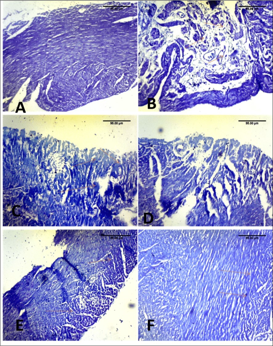 Effect of paraquat exposure on mast cell distribution of the rat heart(A) Control,  (B) Paraquat only (C) MEAS 100mgkg-1 (D) MEAS 200mgkg-1 (E) Vitamin E 100mgkg-1, (F)                Recovery group. TB(x40)