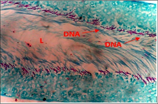 Normal Control (NC) X400 – Section of testis showing numerous deeply stained DNA with              magenta color.