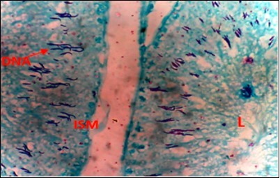 Diabetic Control (DC) X400 – Section of testis showing scanty DNA stained with magenta colour.  DNA strands are cross linked and appear in clusters