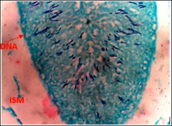 DC+250mg/kg.bw of AP X400 – Section of testis showing scanty DNA deeply stained with             magenta color.  DNA strands are in clusters