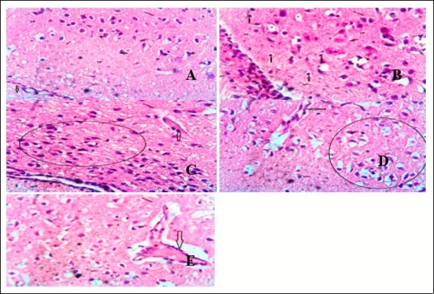 Showing the Hypothalamus of mice. Group A shows clusters of hypothalamic nucleus around the paraventricular region (down arrow); magnocellular nuclei appear normal and unremarkable (4-point star). Group B shows a number of glial cells (up arrow). Group C shows cluster of cells and hypothalamic nuclei (circle). Group D shows the capillary is free from cellular and vascular response (Left Arrow). Group E shows a congested capillary (down arrow) with marked degenerative feature. (x400) H&E