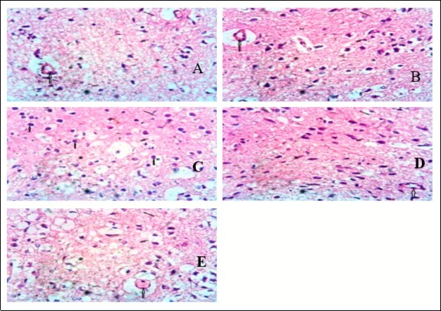 Showing the pituitary of mice. Group A shows the normal pituitary gland (Pars nervosa)                consisting of essentially appearing pituitcytes and the capillaries (up arrow). Group B shows the capillary (up arrow). Group C shows a number of pituitcytes and a remarkably appearing micromophorlogy. Group D shows the capillary (up arrow) free from cellular and vascular response. The pituitcytes appear normal. Group E shows congestion in the capillary (up arrow) showing cellular response. (x400)  H&E