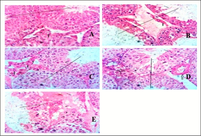 Showing the testes of mice. Group A shows the normal testes consisting of numerous                  seminiferous tubules (ST) which compose of spermatogenic cells (germ cells) at varying degree of         maturation. Group B shows scanty interstitial cells. Seminiferous tubules are separated by wide                   interstitium showing a possibility of degeneration of the spermatids. Group C shows a mild proliferation of interstitial cells (up arrow). Also the seminiferous tubules (ST) show spermatids at varying level of                      maturation Group D shows the blood vessel (up arrow). There is no remarkable inflammatory cell within the interstitial cell. Group E shows congestion of interstitial cell (ICG) and proliferation of interstitial cell. (x400) H&E
