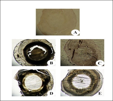 Immunohistochemistry of αA and αB crystallin in the eye lens from different experimental group animals. Lens sections were preincubated with anti- αA, αB crystallin polyclonal rabbit antibody (1: 500 dilution) and subsequently with goat anti-rabbit IgG-HRP (1: 3000 dilution). The immunoreactivity was developed with 0.01% DAB and H2O2. Note the brown colour formation that is indicative of peroxidase reaction in the nucleus. Inset (A):  Physiological saline treated (group I); (B) Selenite treated (group II); (C) Selenium and resveratrol administered simultaneously (group III); (D) Resveratrol administered 24 h after treatment with selenite (group IV); (E) Resveratrol administered 24 h before treatment with selenite (group V).