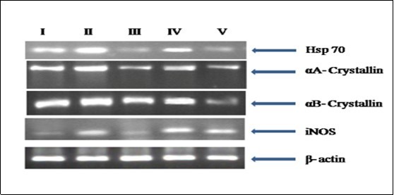 RT PCR analysis for Hsp 70, iNOS, αA and αB crystallin gene expression in the eye lens from different experimental group animals. Reverse transcribed cDNA isolated from- Lane I: control (group I); lane II selenite only (group II); lane III: selenium + resveratrol simultaneously (group III); lane IV: Resveratrol administered 24 h after treatment with selenite (group IV); lane V: Resveratrol                 administered 24 h before treatment with selenite (group V).