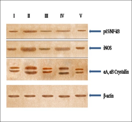 Western blot analyis for p65/NF-kB, iNOS, αA and αB crystallin protein expression in the eye lens from different experimental group animals. Lens homogenates from from- Lane I: control (group I); lane II selenite only (group II); lane III: selenium + resveratrol simultaneously (group III); lane IV: Resveratrol              administered 24 h after treatment with selenite (group IV); lane V: Resveratrol administered 24 h before treatment with selenite (group V). ). Separated lens protein was pre-incubated with anti-iNOS, p56/NF- kB and αA, αB crystallin polyclonal rabbit antibody (1: 500 dilution) and subsequently with goat anti-rabbit IgG-HRP (1: 2500 dilution). The immunoreactivity was developed with 0.01% DAB and H2O2.