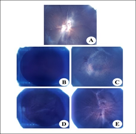 NBT reduction in the eye lens of from different experimental group animals to assay for               superoxide anion generation. Blue colour formation upon incubation with 0.3% NBT for observed after 45 min with intense blue colour formation indicative of superoxide anion generation. Inset (A): Physiological saline treated (group I); (B) Selenite treated (group II); (C) Selenium and resveratrol administered                     simultaneously (group III); (D) Resveratrol administered 24 h after treatment with selenite (group IV); (E) Resveratrol administered 24 h before treatment with selenite (group V).