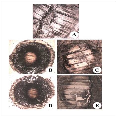 Immunohistochemical analysis of iNOS in the eye lens from  different experimental group animals. Lens sections were preincubated with anti-iNOS polyclonal rabbit antibody (1: 500 dilution) and subsequently with goat anti-rabbit IgG-HRP (1: 3000 dilution). The immunoreactivity was               developed with 0.01% DAB and H2O2. Note brown color formation indicative of  peroxidase reaction in the nucleus. Inset (A): Physiological saline treated (group I); (B) Selenite treated (group II); (C)   Selenium and resveratrol administered simultaneously (group III); (D) Resveratrol administered 24 h after treatment with selenite (group IV); (E) Resveratrol administered 24 h before treatment with selenite (group V).