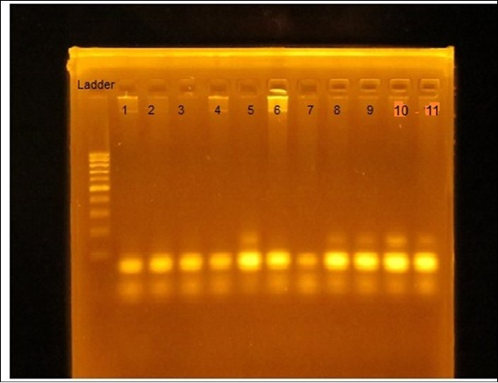 Gel picture of PCR products digest by HindIII restriction enzyme (HAMP). 100 b.p DNA Ladder (100–1000 b.p). Lane 1, 2, 3, 4, 6, 7 : GG homozygote alleles (bands at 90 bp and190 bp). Lane  8, 9, 10, 11: AG heterozygote alleles (bands at 90 b.p, 190 b.p, and 200 b.p). Lane 5: AA homozygote alleles (band at 200 bp).
