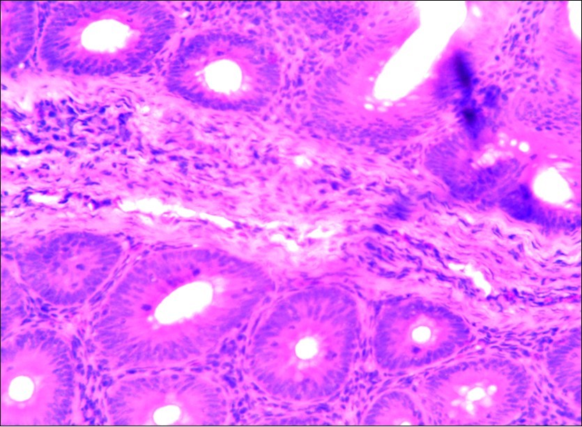 Photomicrograph of caecum of chick uninfected and untreated showing no    observable lesion X250 (H&E).