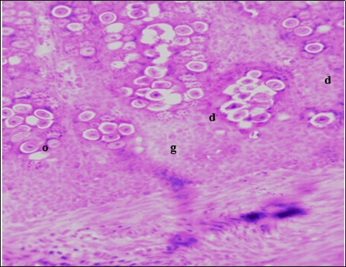 Photomicrograph of caecum of chick administered 20000 Oocysts of Eimeria tenella and untreated showing generalized degeneration of the                caecal glands (d) with massive Ocysts (o) and gametocytes (g) largely within the caecal glands X250 (H&E).