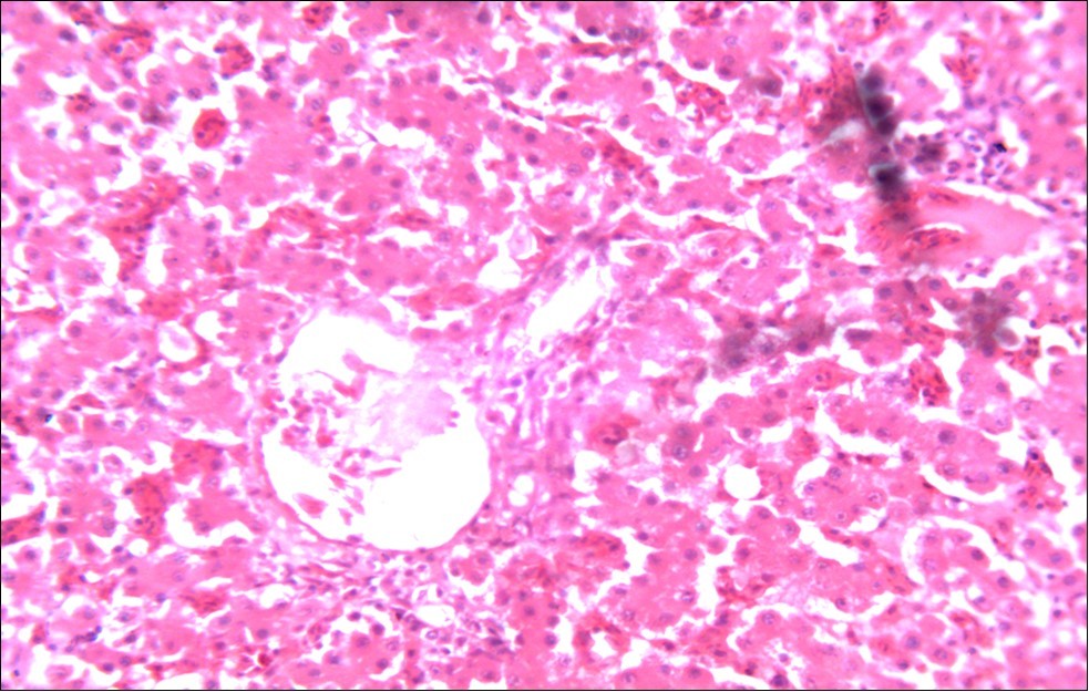 Photomicrograph of liver of chick administered NeemAzal® at 200 mg/kg showing no                  observable lesion X250 (H & E)