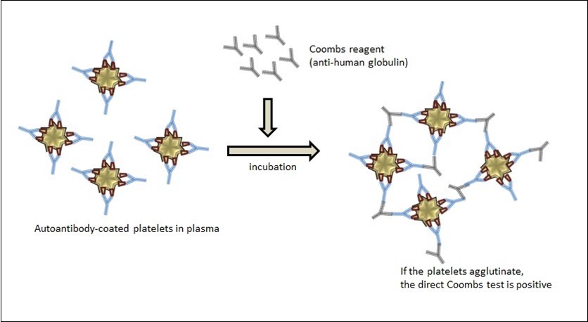 Detection of platelet antibodies by Coombs test