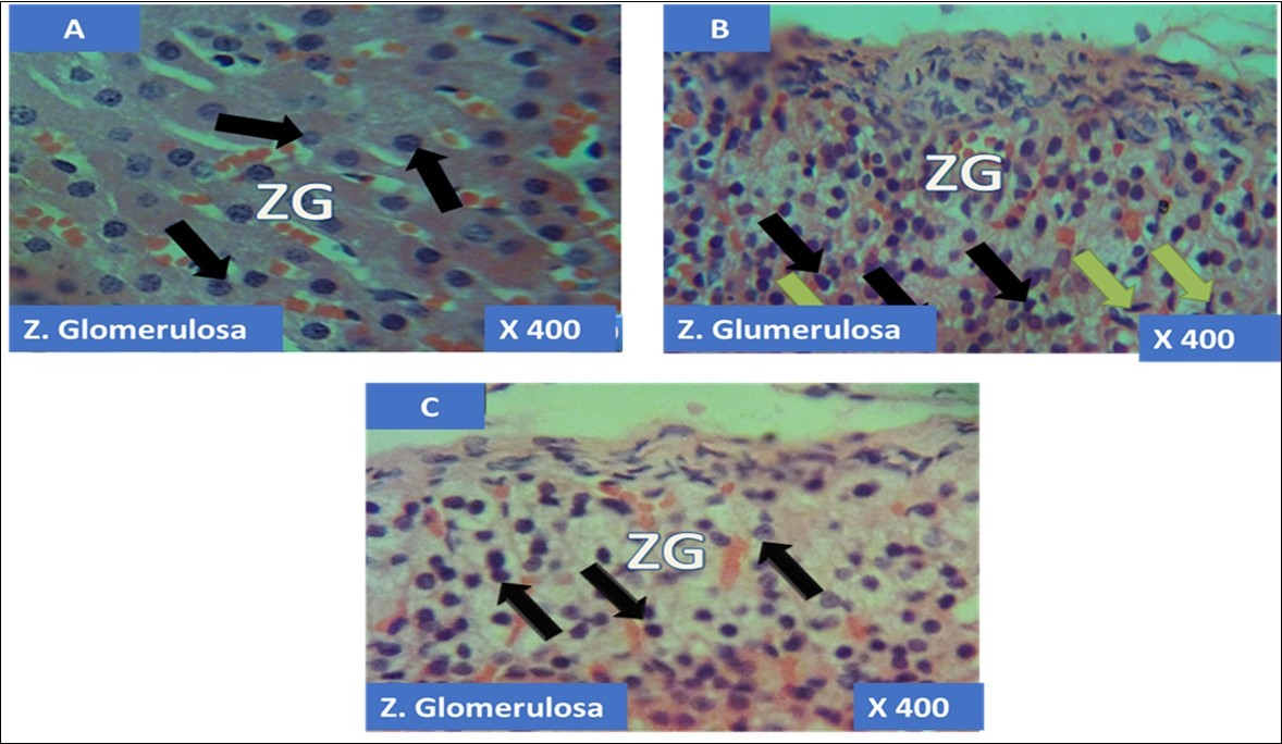 showing the cellular layer of Zona Glomerulosa of Adrenal gland group A (control), group B (T1) and group C (T2). The evenly distributed normal columnar cells with dark nuclei in A (black                   arrows), evenly distributed normal pyramidal cells (black arrows) with few obliterated cells (green                     arrows) in B and in C, the black arrows pointing to  the evenly distributed normal polydhedral cells (black arrows) having long, straight cords of large cells, swollen with lipid droplets. H&E x400