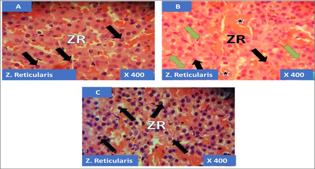 showing the cellular layer of Zona Reticulosa of Adrenal gland group A (control), group B (T1) and group C (T2). The evenly distributed normal polydhedral cells in A (black arrows), evenly                           distributed normal polydhedral cells (black arrows) with few obliterated cells (green arrows) as well as                            haemorrhagic necrosis sites (Black stars) in B and in C, the black arrows pointing to the evenly                          distributed normal polydhedral cells (black arrows). H&E x400